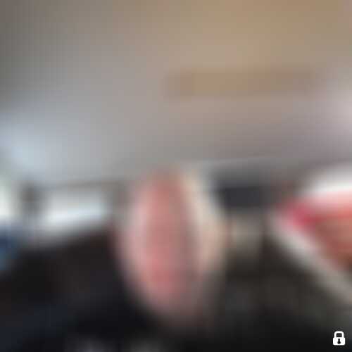 BiAmputee