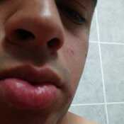 Elbry1