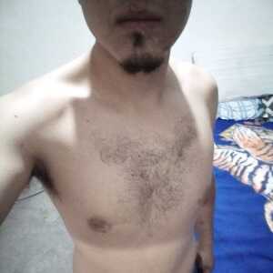 Alkilesbaeza