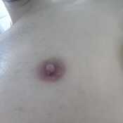 ThickMushroom