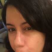 naal577