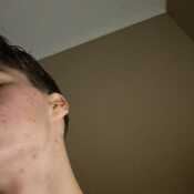 Youngguy
