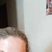 Dewder