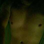 Morbosocaliente