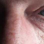 Pecas