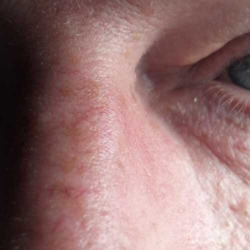 Pecas