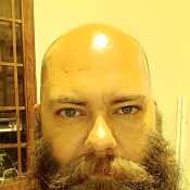 BaldNBearded84