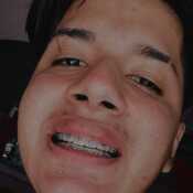 Cotanx