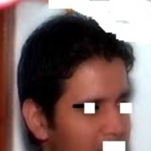 gnmada1