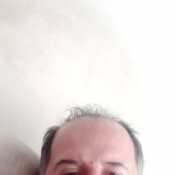alm115