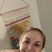 Carneal Ann