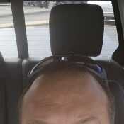 Puckhead