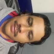 aambeto