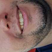 lucerogonzalo87