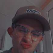 analfotz