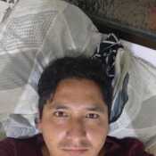 lopga521