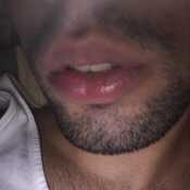 Tpiazo1