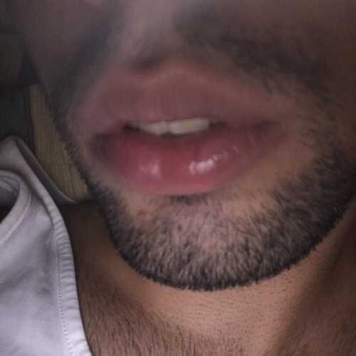 Tpiazo1