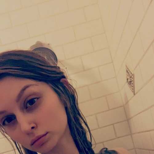 SWeetGAL31