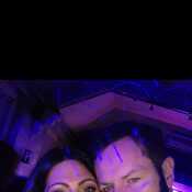 Dimples