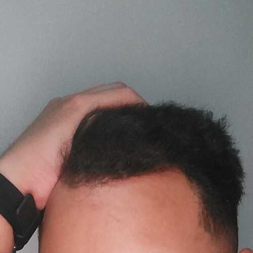 Neialfo443
