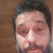 raulitoelba491