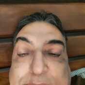 Kotu