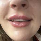 MegsxLb