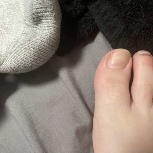 Ynglildick