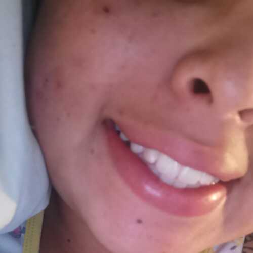 Natyy20