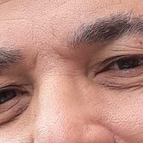 Albert 