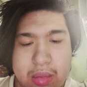 brentxyle