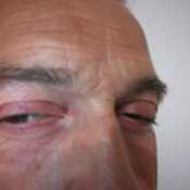 coccolo