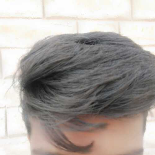 xple104