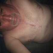 Big nob