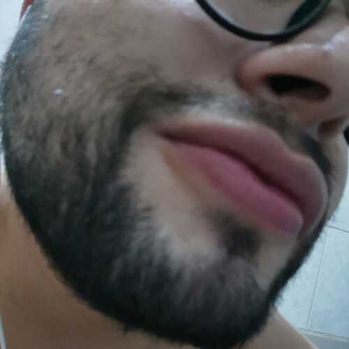 teddalex