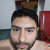 sebacaacatic191