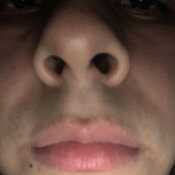 matiasrav704