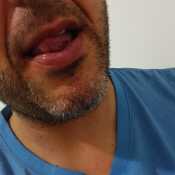 luishpote06