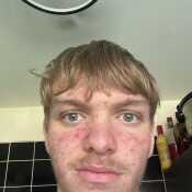 Cam