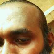 Yohan