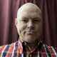 Skinhead